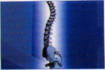 Клініка Цілитель, Оболонь, Мінський масив